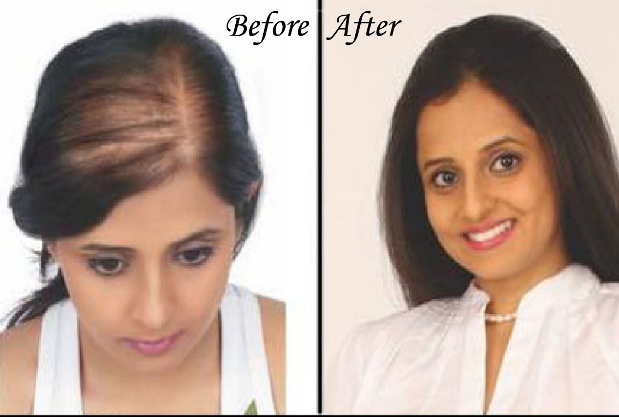 Women Hair Wig And Extention